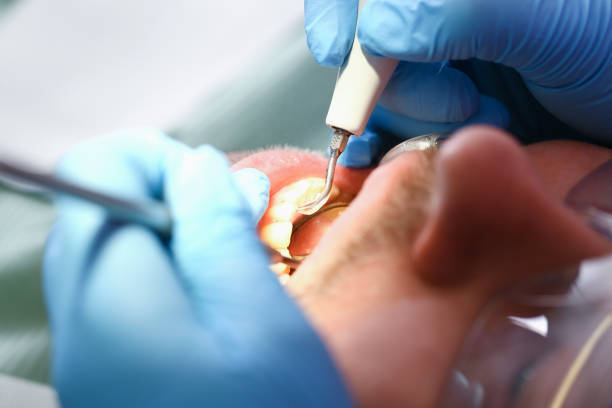 Best Emergency Broken Tooth Repair in Duncansville, PA